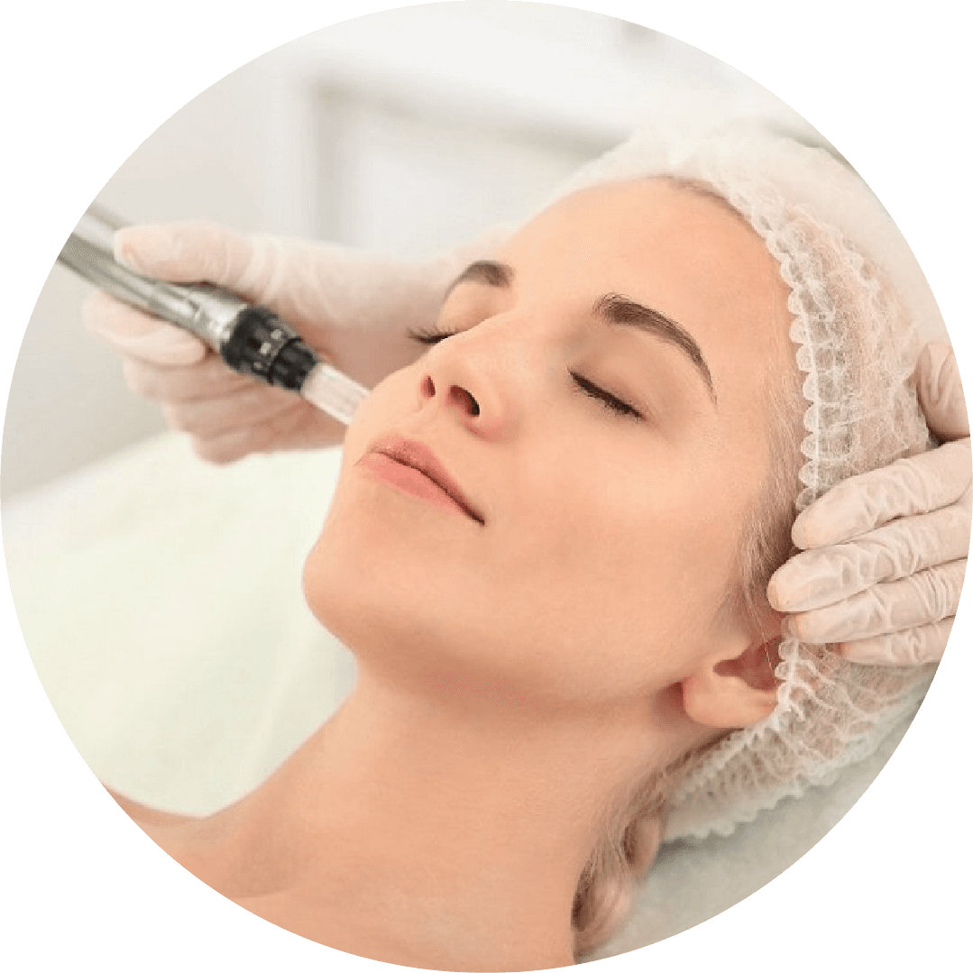 Microneedling