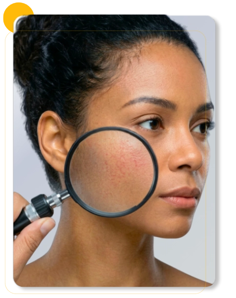 Mulher com pele do rosto em avaliação dermatológica para vermelhidão e sensibilidade na bochecha